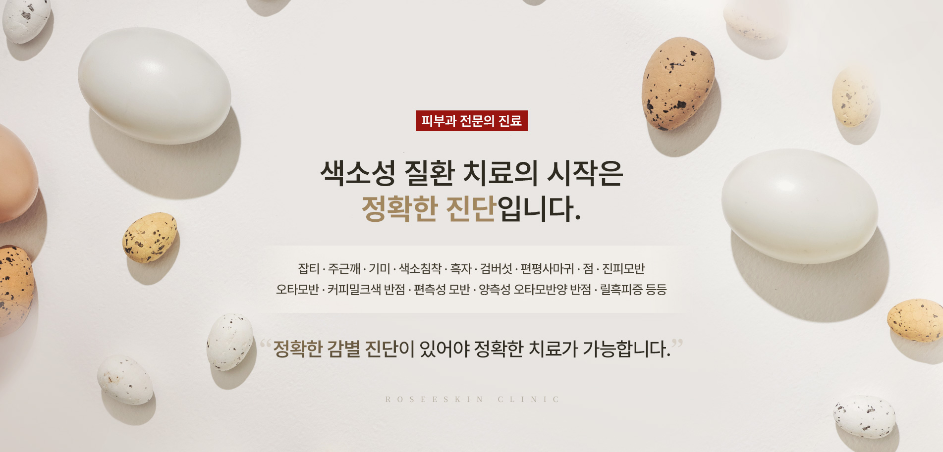 로제 색소치료