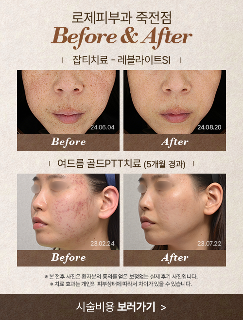 시술비용안내